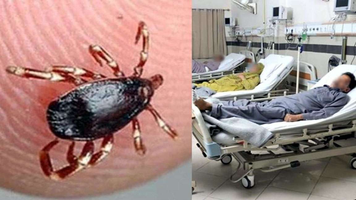 Khyber Pakhtunkhwa reports 14 cases of Congo virus in 2023